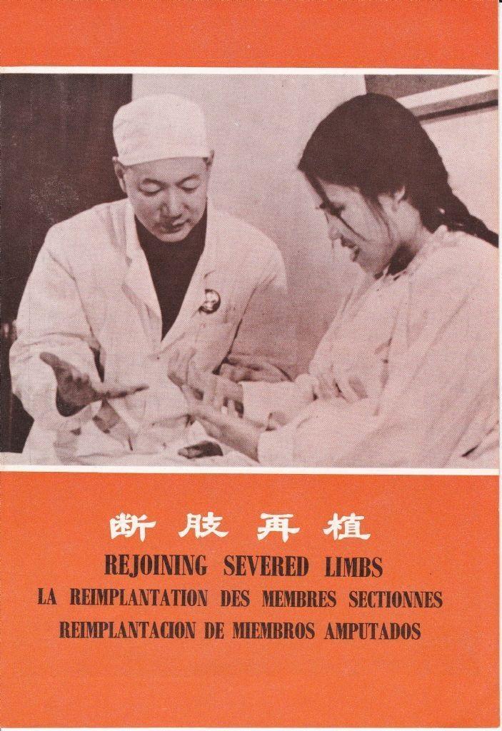 斷肢再植