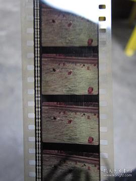 性病防治 圖6